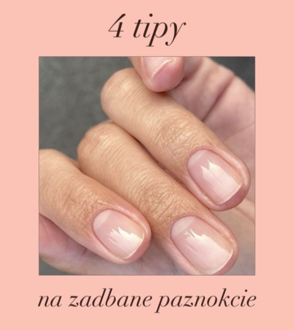 4 TIPY na zadbane paznokcie💅: 
- ZMIĘKCZANIE - kremem z mocznikiem 5-10%
- NAWILŻANIE - kremem bogatym w kwasy tłuszczowe, lipidy i cholesterol 
- NATŁUSZCZANIE - maścią z lanoliną, cholesterolem oraz olejami i olejkami pochodzenia roślinnego
- SUPLEMENTOWANIE - preparatami z biotyną